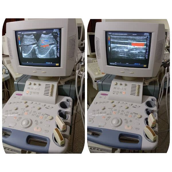 ALL TYPES OF ULTRASOUND MACHINES AVAILABLE FOR SALE 18