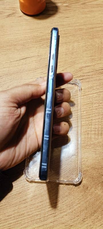 Redmi note 11 pro 3