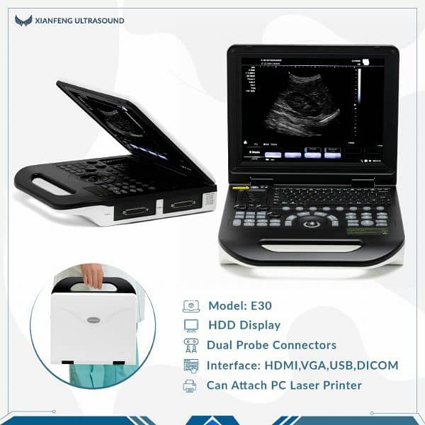 Brand new Color Doppler ultrasound machine amazing best price Pakistan 2