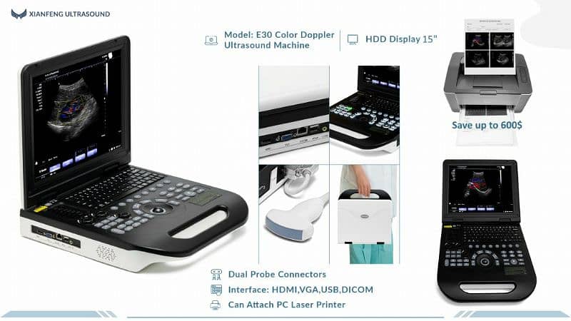 Brand new Color Doppler ultrasound machine amazing best price Pakistan 4