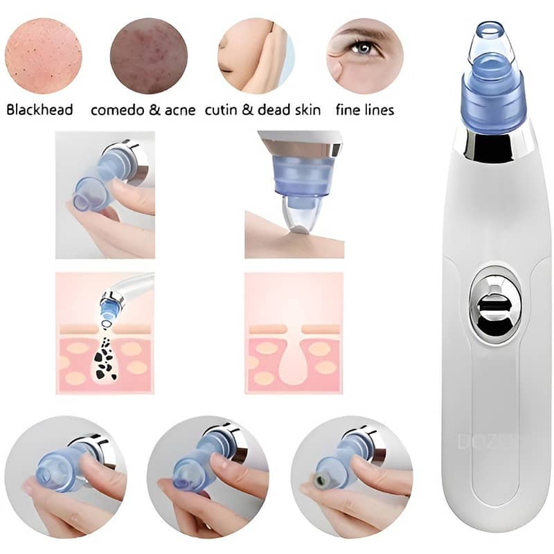 Derma Suction Blackhead Removal Machine 4 in 1 - Acne Pore Cleaner Vac 6