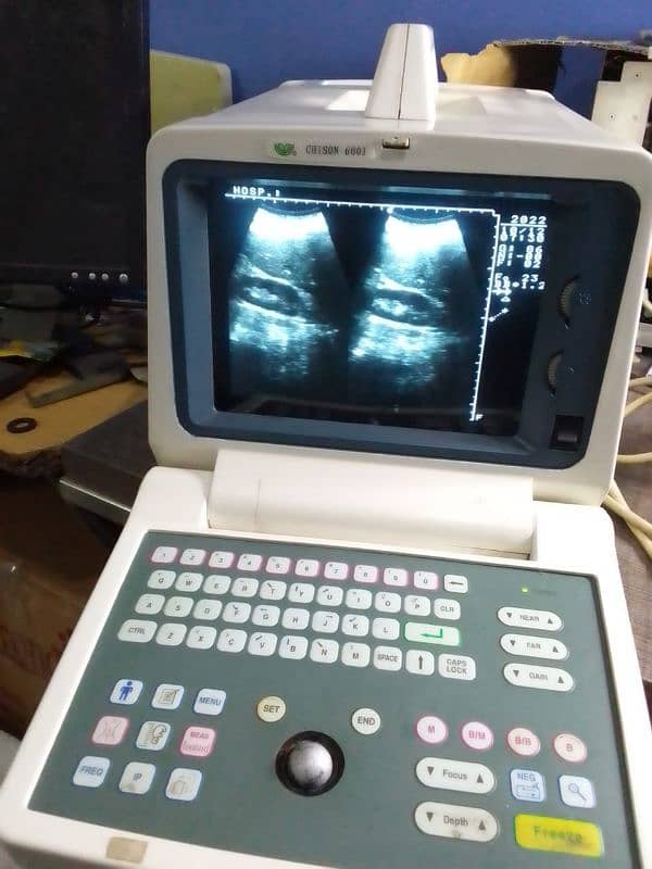 new branded ultrasound 0