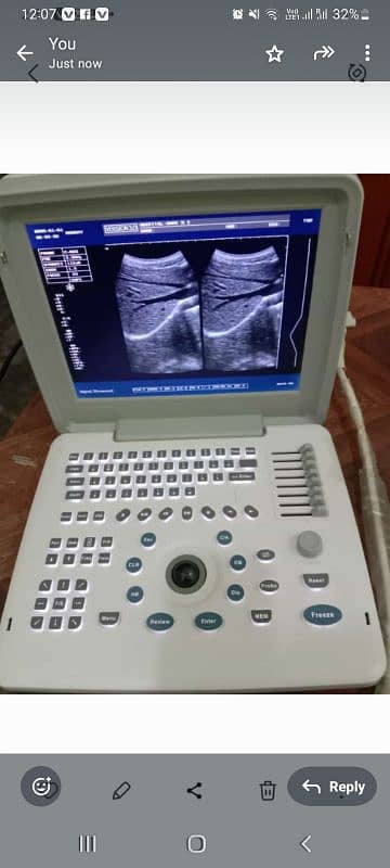 Ultrasound machine New Stock Available Whtsap-03126807471 1