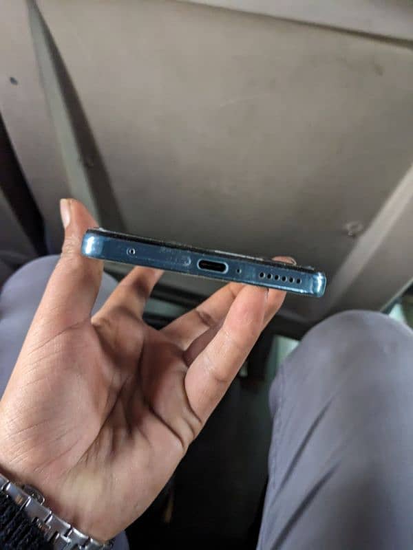 Redmi note 11 pro 6/128 condition 10/10 5