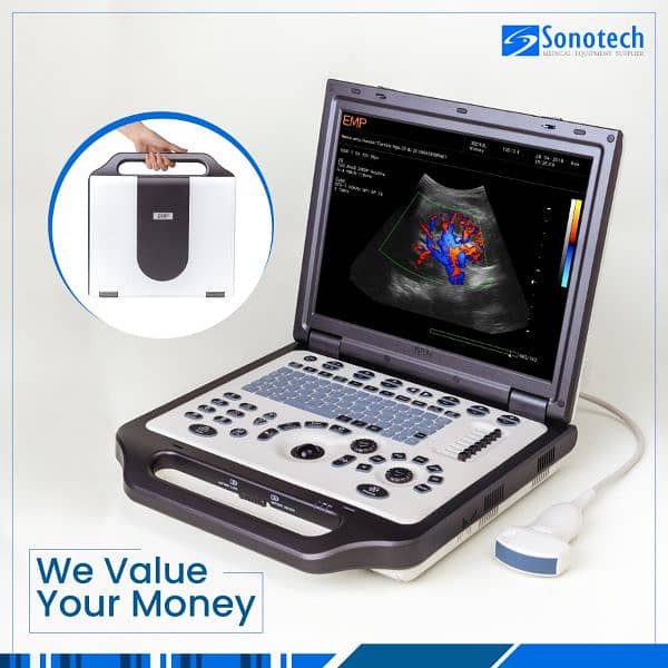 Brand new Color Doppler ultrasound machines  amazing price 03214456215 2