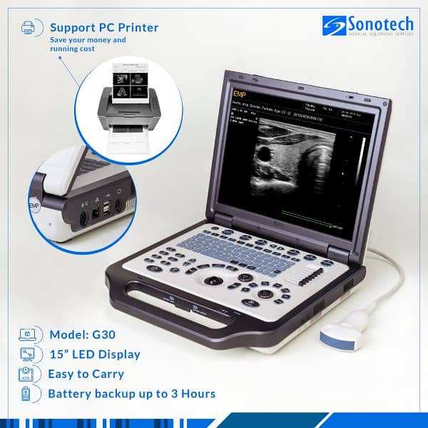 Brand new Color Doppler ultrasound machines  amazing price 03214456215 3