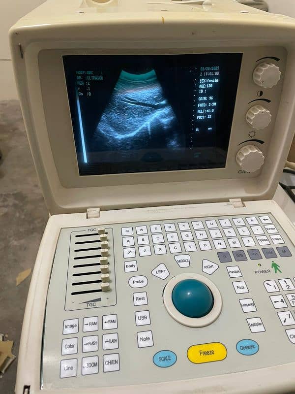 Ultrasound machine New Stock Available Whtsap-03126807471 1