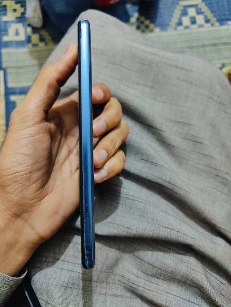 Redmi Note 11 3