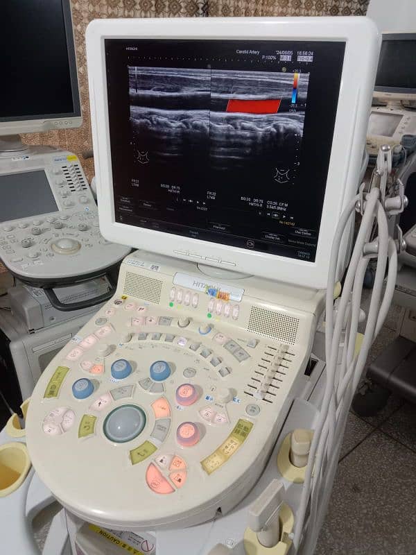 Ultrasound&  Echo Machines 19