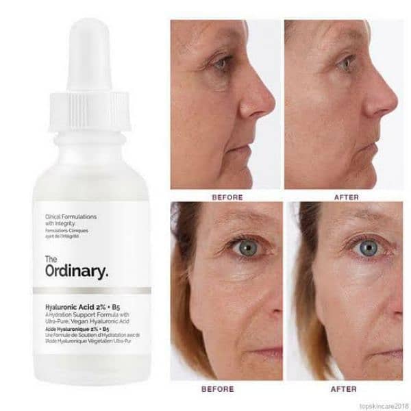 The Ordinary Niacinamide Serum – Blemish Control & Smoother Skin 1