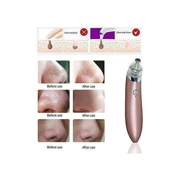 5-in-1 Rechargeable Blackhead Remover 4