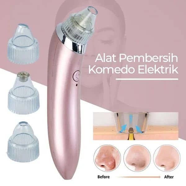 5-in-1 Rechargeable Blackhead Remover 6