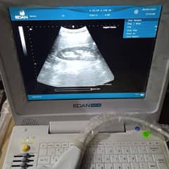 EDEN DUS 60 FOREIGN USED ULTRASOUND MACHINE