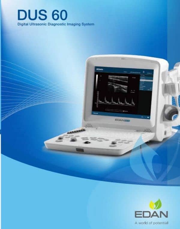 EDEN DUS 60 FOREIGN USED ULTRASOUND MACHINE 1