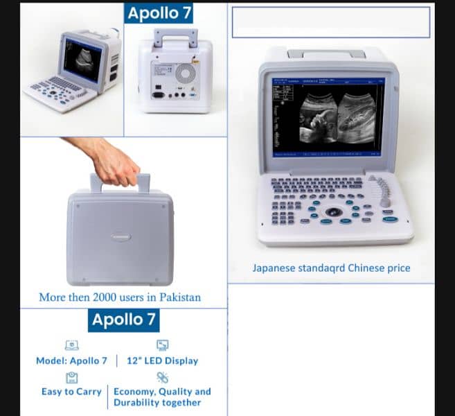 Brand New Portable Apollo 7 Ultrasound Machine Available in Stock 0