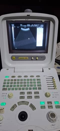 Portable Foreign Used Ultrasound Machine