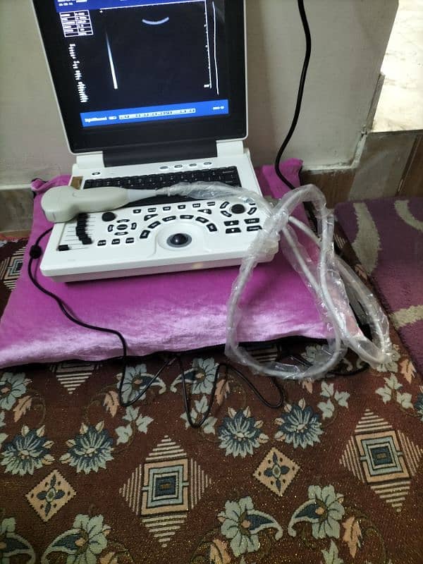 portable ultrasound machine 1