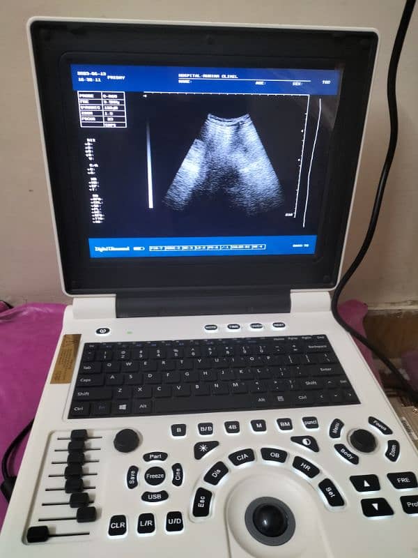 portable ultrasound machine 3