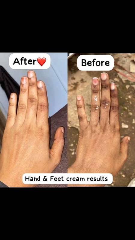 magical Hands & feet whitening Cream 1