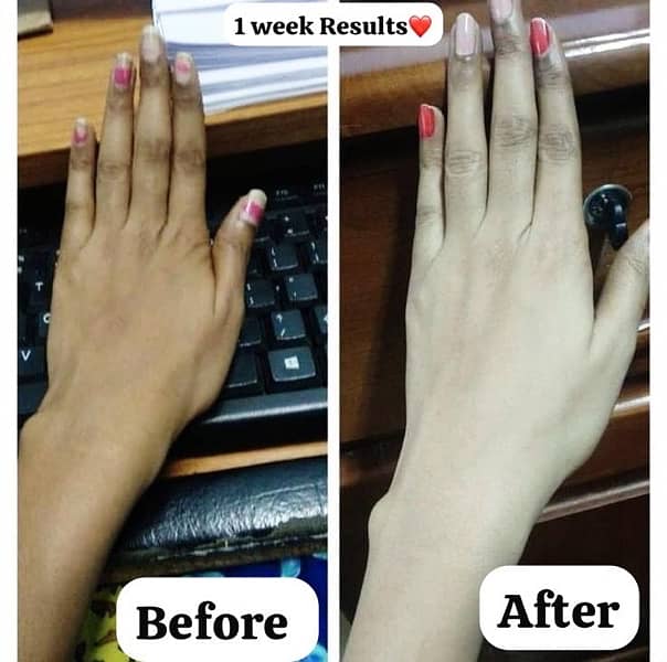 magical Hands & feet whitening Cream 2