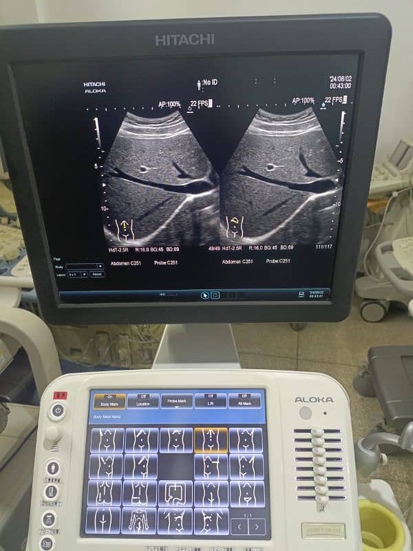 Ultrasound Machines 03125374849 18