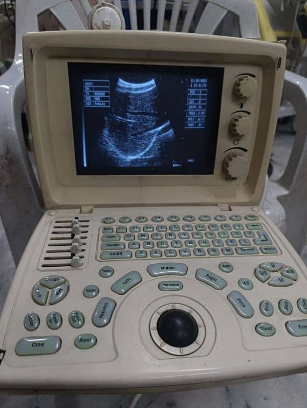 Ultrasound Machine in 99,000 0