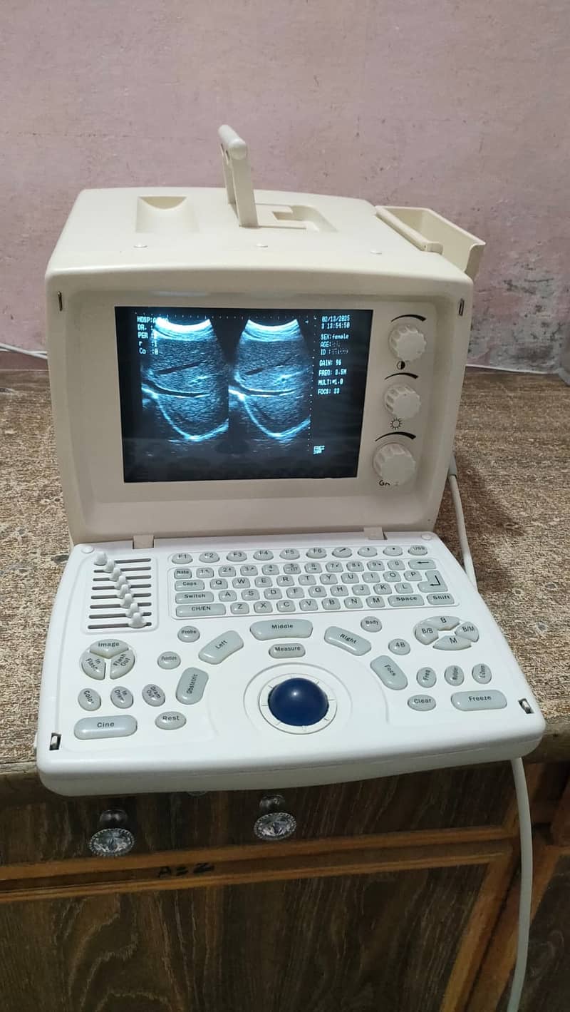 DIFFERENT ULTRASOUND MACHINES AVAILABLE IN NEW AND USED CONDITION 1