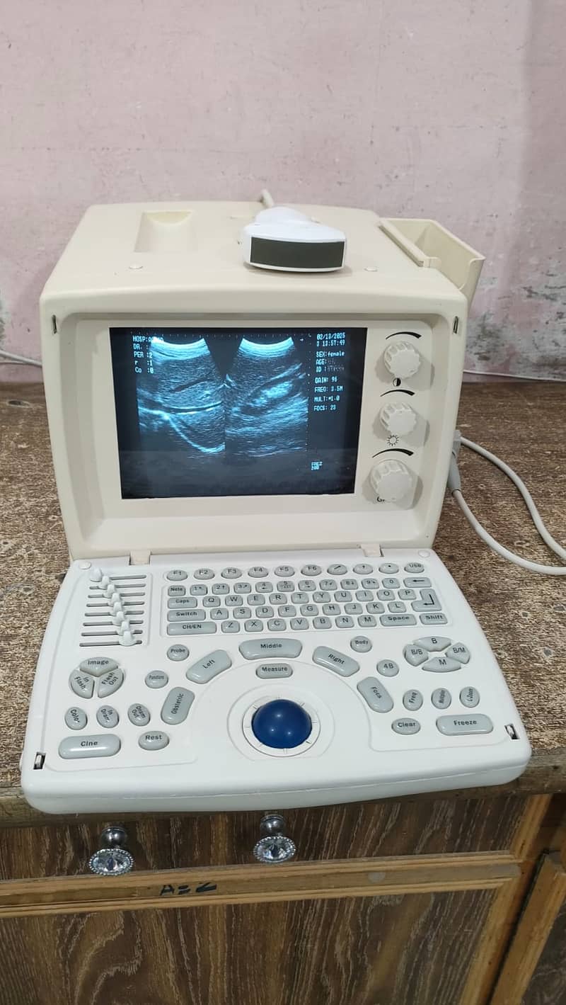 DIFFERENT ULTRASOUND MACHINES AVAILABLE IN NEW AND USED CONDITION 3