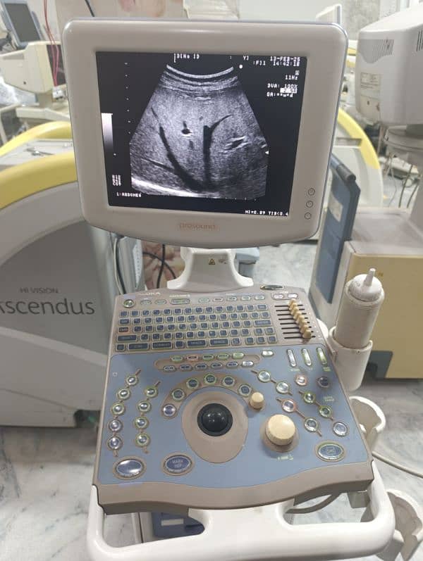 Ultrasound Machine in 99,000 9