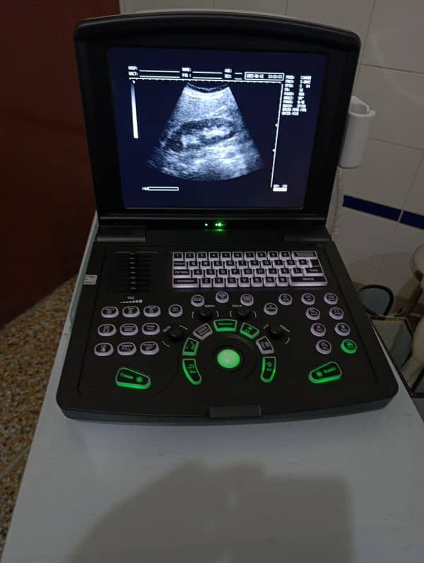 Ultrasound Machine in 99,000 10