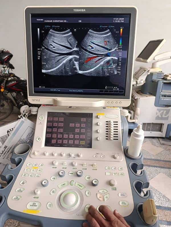 Honda HS-2500 Ultrasound Machine 16