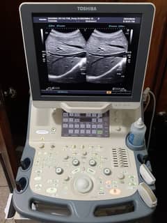 Japan Used Ultrasounds, Colour Dopplers & Cardiac Units