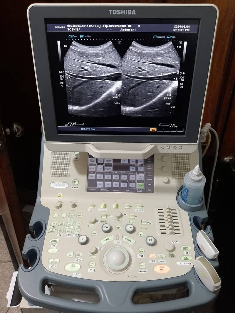 Japan Used Ultrasounds, Colour Dopplers & Cardiac Units 4