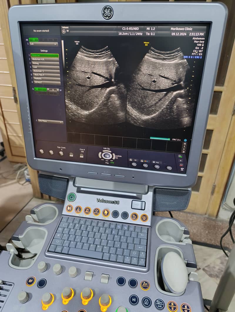 Japan Used Ultrasounds, Colour Dopplers & Cardiac Units 7