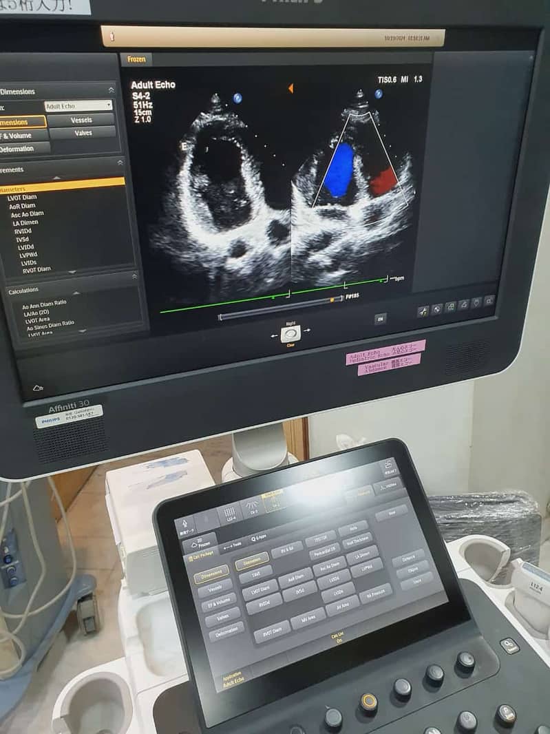 Japan Used Ultrasounds, Colour Dopplers & Cardiac Units 10