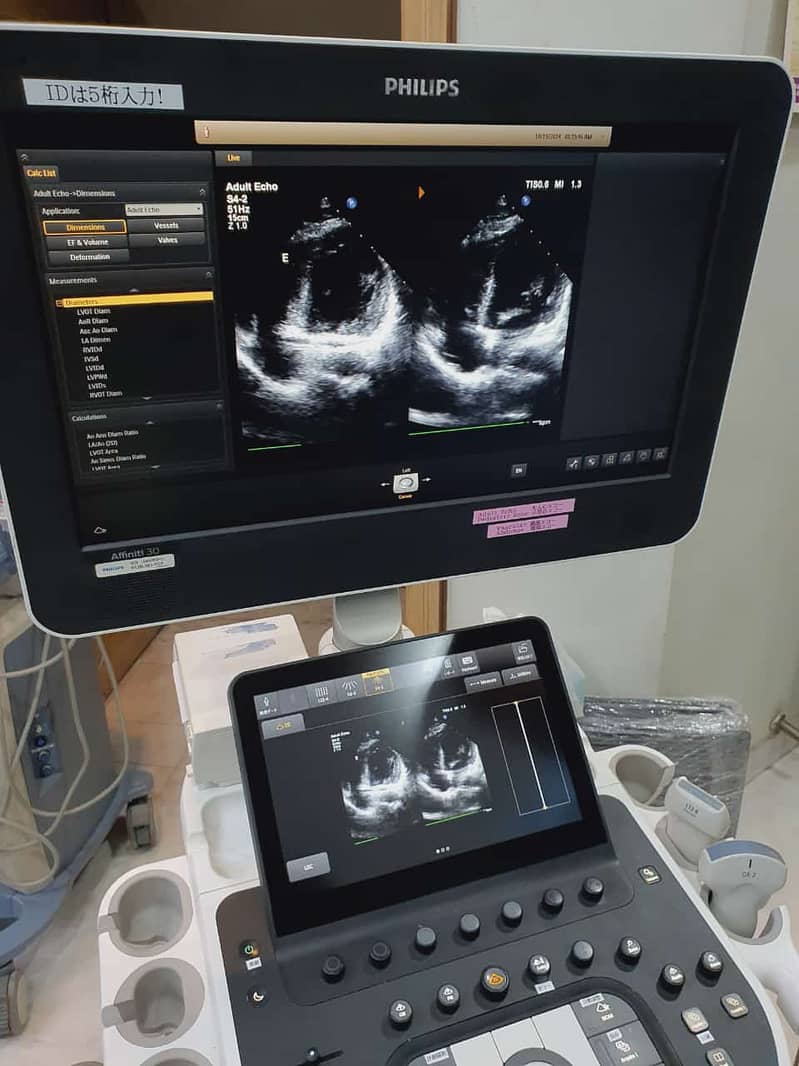 Japan Used Ultrasounds, Colour Dopplers & Cardiac Units 11