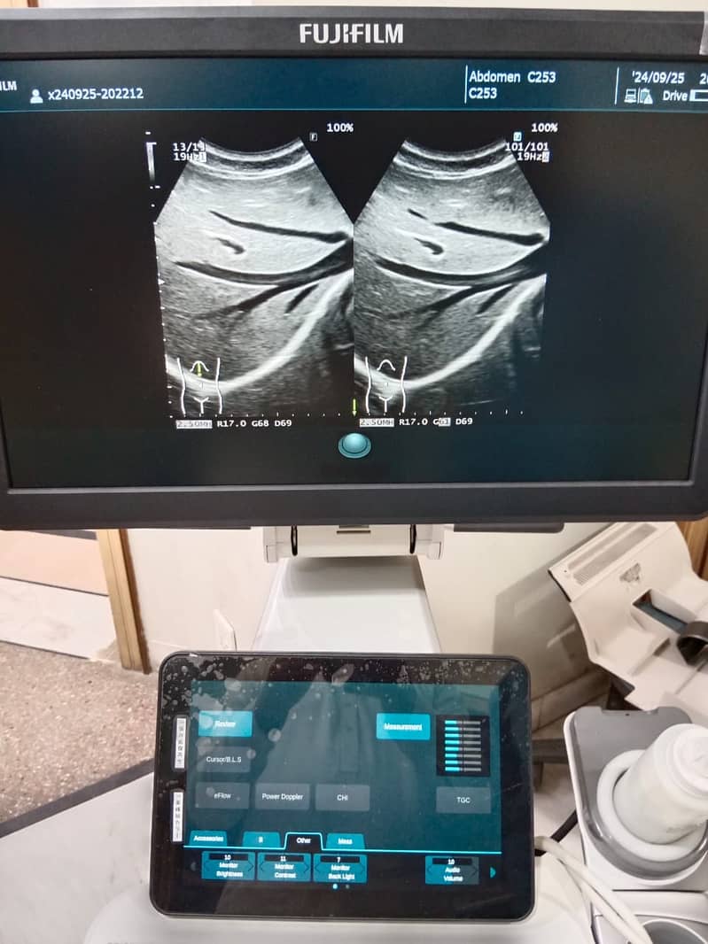 Japan Used Ultrasounds, Colour Dopplers & Cardiac Units 14