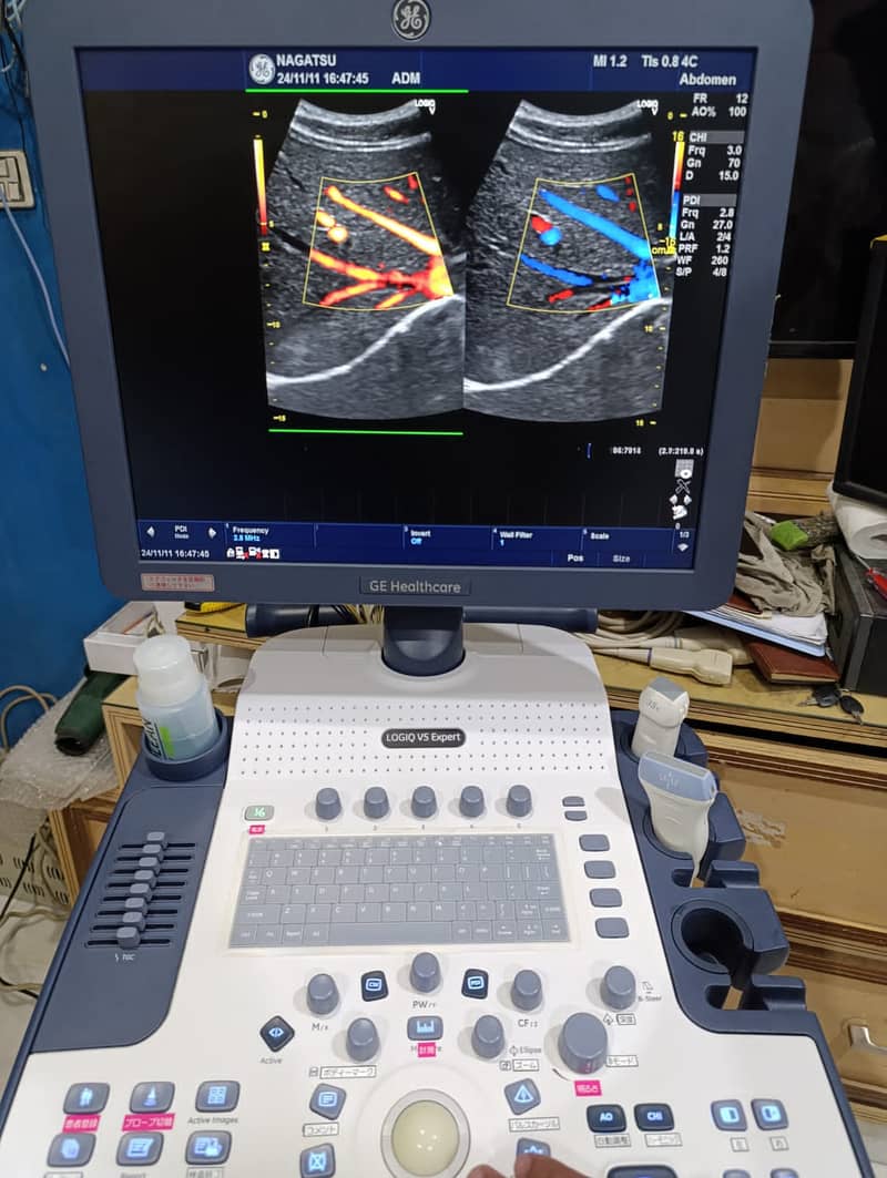 Japan Used Ultrasounds, Colour Dopplers & Cardiac Units 18