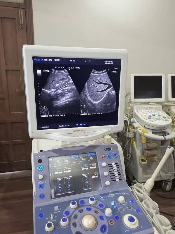 Japan / Europe Used Ultrasounds, Dopplers & Cardiac Units 0