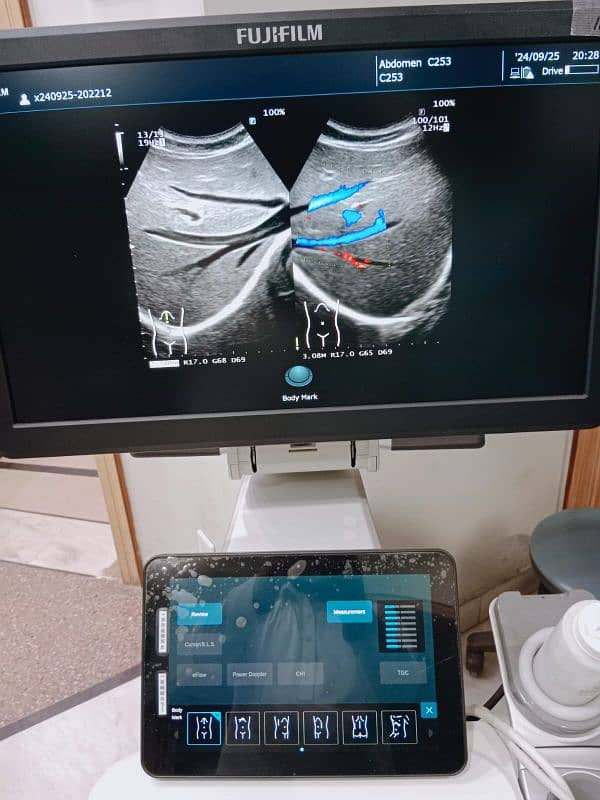 Japan / Europe Used Ultrasounds, Dopplers & Cardiac Units 15