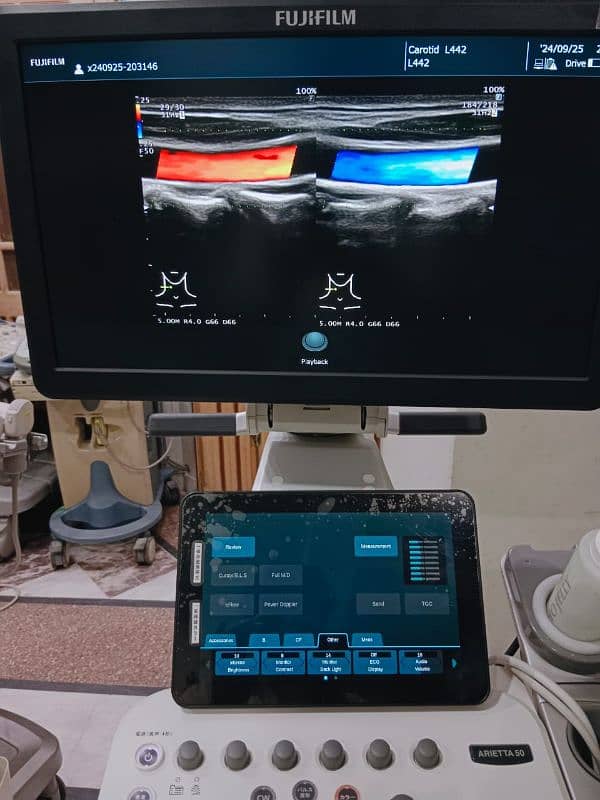 Japan / Europe Used Ultrasounds, Dopplers & Cardiac Units 17