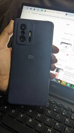 Xiaomi