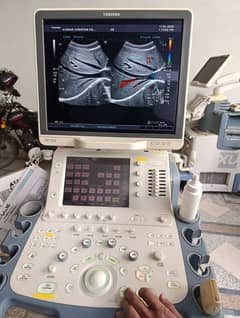 Toshiba GE Japan / Europe Used Ultrasounds/Color Dopplers