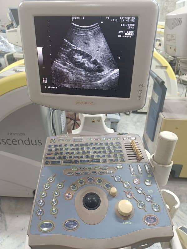 Europe/Japan Used Ultrasounds 1