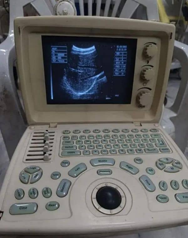 Foreign Used Ultrasounds & Dopplers 7