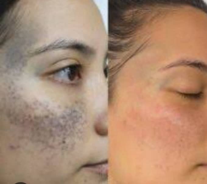 Dermatologically tested beauty face cream for melasma and dark spots 3