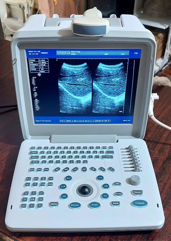 Ultrasound Machines China & Refurbished 17