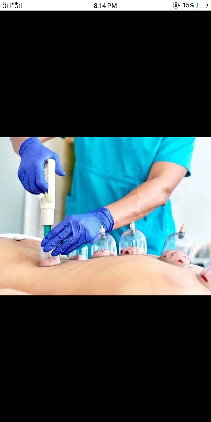 Hijama services 0