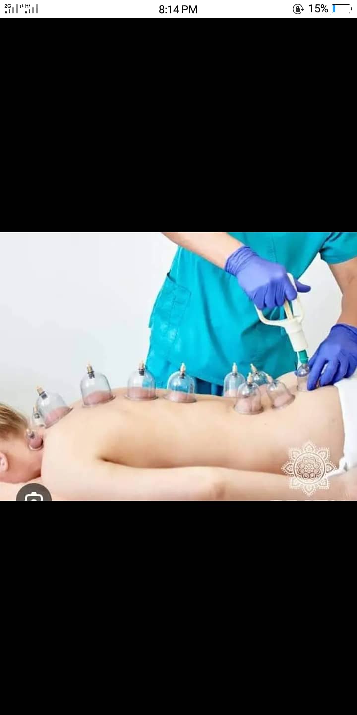 Hijama services 1