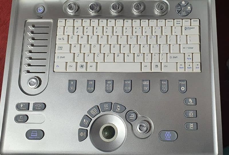 laptop ultrasound machine 1